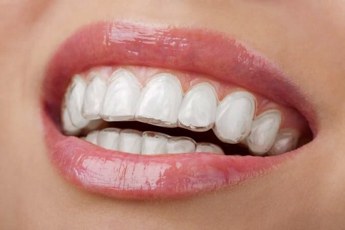 Görünmez ama etkili